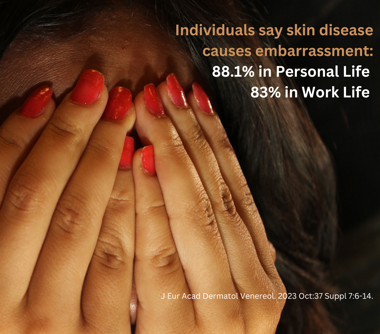 Embarassemtn and skin disease data
